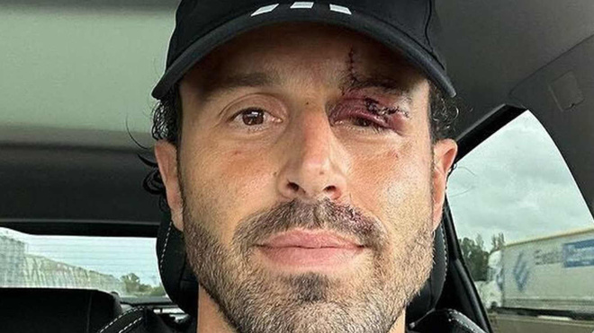 Fabio Grosso encore hanté par OM‑OL : « J’ai cru mourir » Fabio Grosso encore hanté par OM‑OL : « J’ai cru mourir »